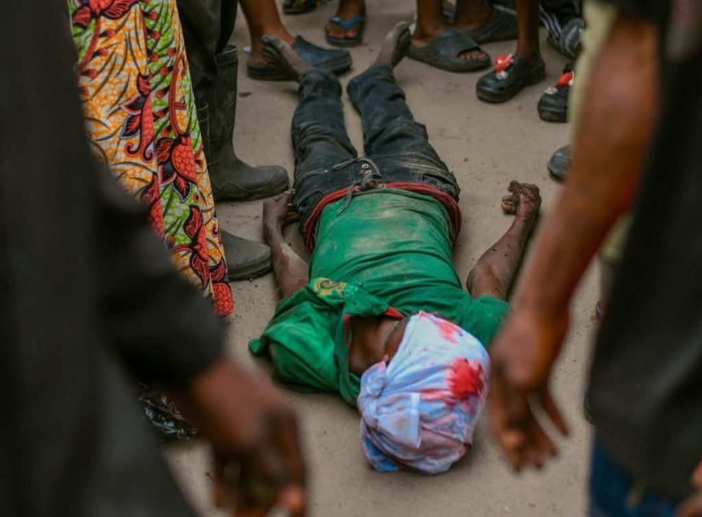 Kinshasa : un homme meurt après des symptômes présumés de choléra